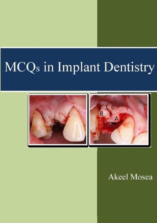MCQS in Implant Dentistry, Akeel Mosea 9781326883195 Boeken
