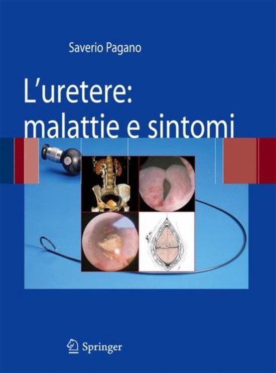 L'uretere: malattie e sintomi - cover