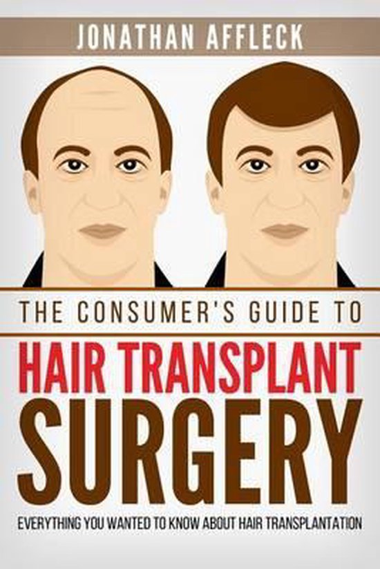 The Consumer's Guide to Hair Transplant Surgery - cover