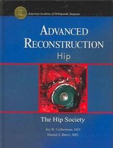 Advanced Reconstruction Hip