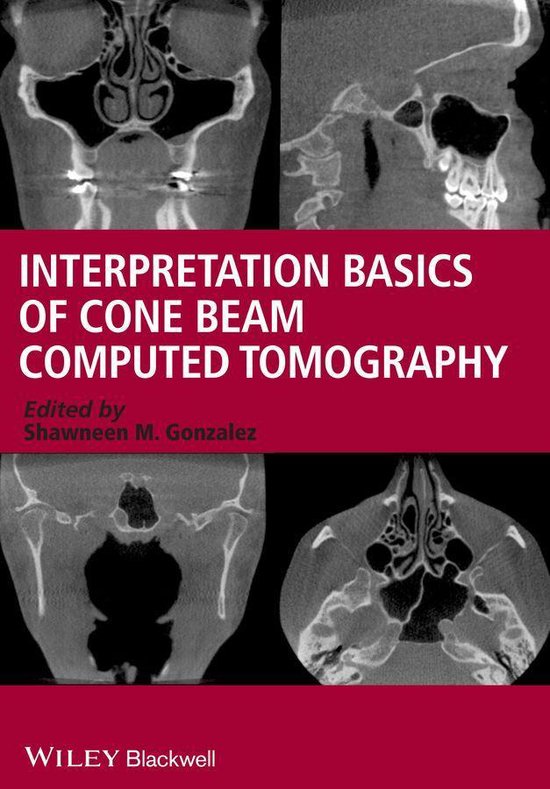 Interpretation Basics of Cone Beam Computed Tomography (ebook ...