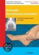 Arterielle Verschlusskrankheiten