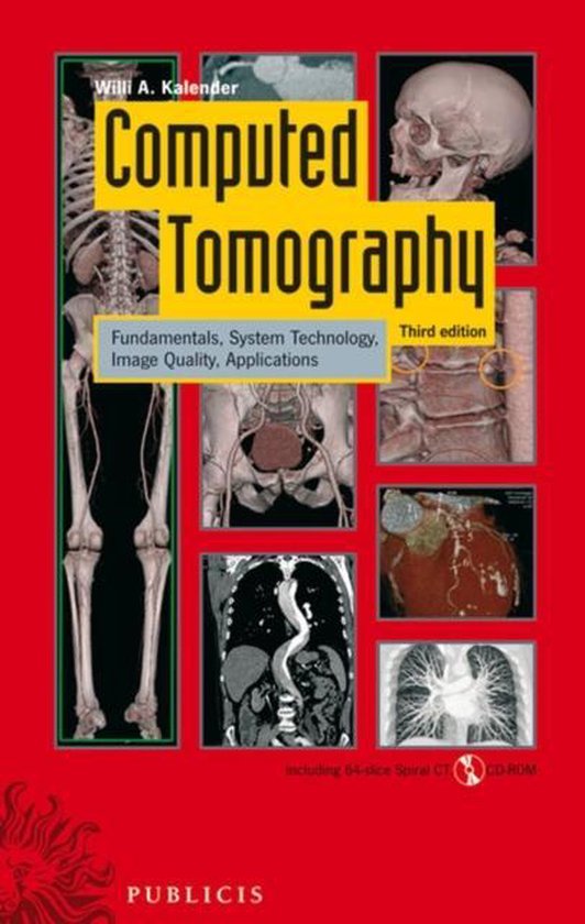 bol.com  Computed Tomography  9783895783173  Willi A. Kalender  Boeken