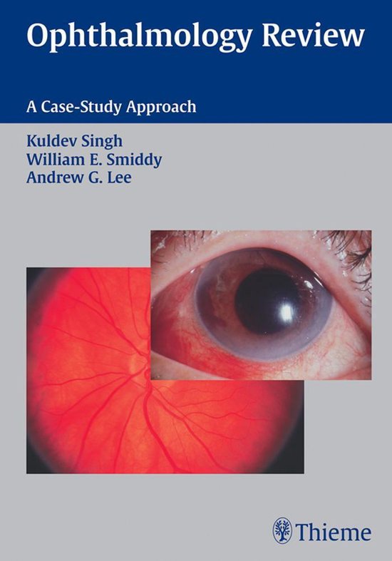 Ophthalmology Review A Case Study Approach (ebook) 9781604065565