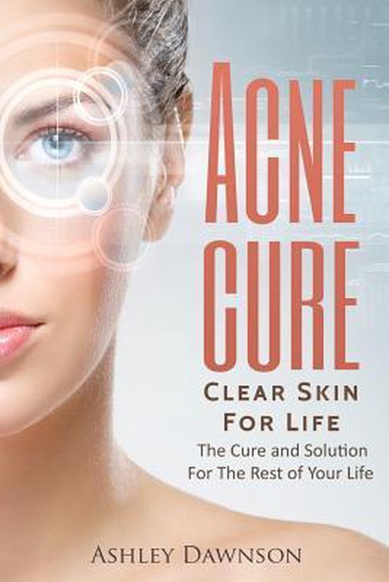 Acne Cure Clear Skin For Life - cover