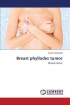 Breast phyllodes tumor