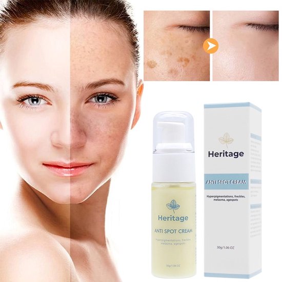 Heritage Organic Anti pigment/spot creme voor hyperpigmentation, freckles,  melasma,... | bol.com