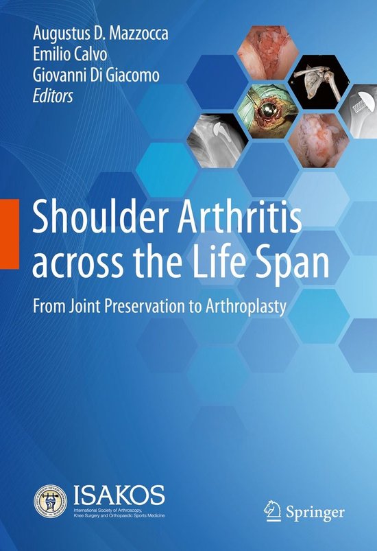 Medicine (R0) - Shoulder Arthritis across the Life Span - cover