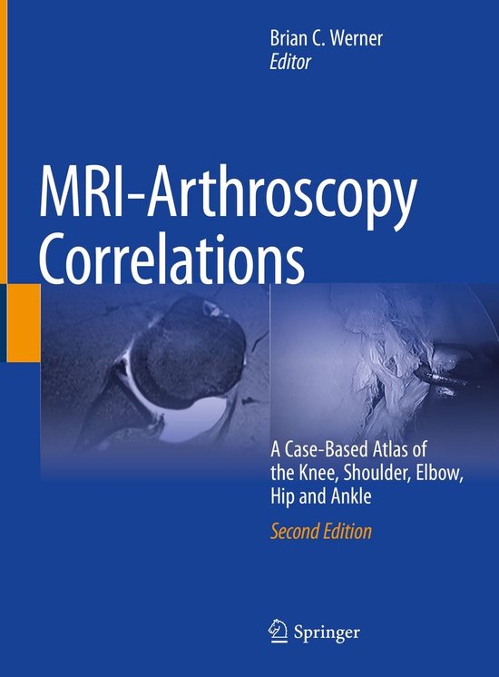 Medicine (R0) - MRI-Arthroscopy Correlations - cover