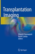 Transplantation Imaging