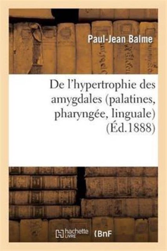 de l'Hypertrophie Des Amygdales (Palatines, Pharyng�e, Linguale)