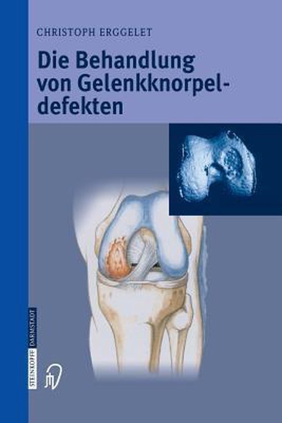 Die Behandlung von Gelenkknorpeldefekten - cover