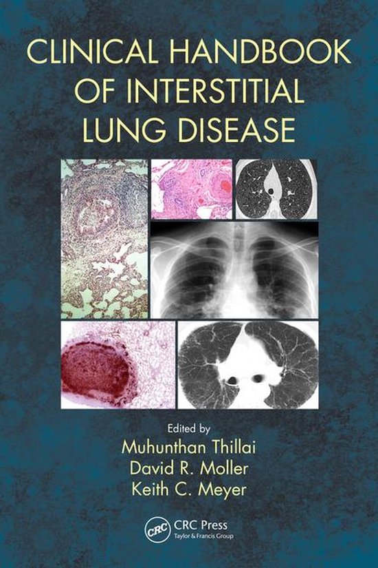 Clinical Handbook of Interstitial Lung Disease - cover