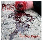 Post-Sepsis Syndrome