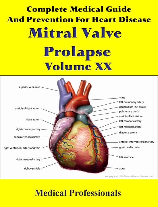 A Complete Medical Guide and Prevention For Heart Diseases Volume XX; Mitral Valve...