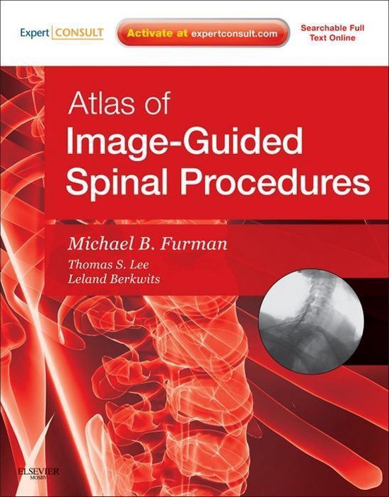 Atlas of image guided spinal procedures ebook michael b furman