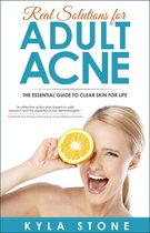 Real Solutions for Adult Acne