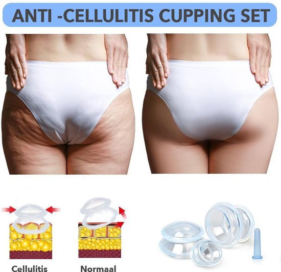 Bol Com Anti Cellulitis Cupping Kit 4 Stuks Kopjes Van Verschillende Grootte