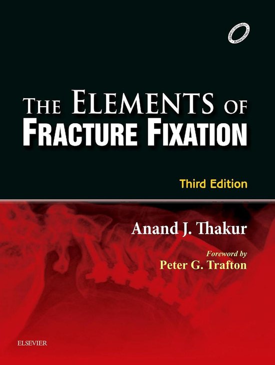 Elements of Fracture Fixation - E-book - cover