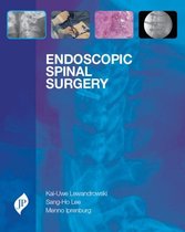 Endoscopic Spinal Surgery