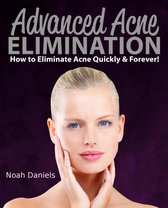 Advanced Acne Elimination