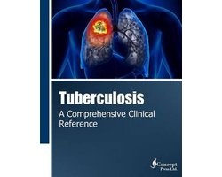 Tuberculosis