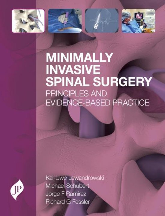 Minimally Invasive Spinal Surgery Kai Uwe Lewandrowski Boeken Bol Com