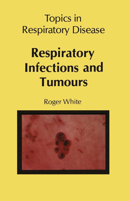 Foto: Respiratory infections and tumours