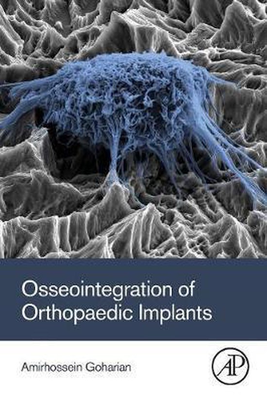 Osseointegration of Orthopaedic Implants