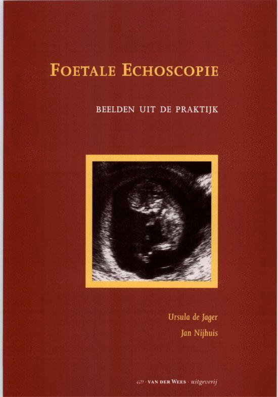 Foetale echoscopie - U. de Jager | Tiliboo-afrobeat.com