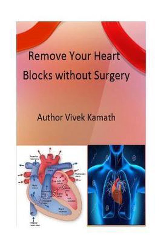 Remove Your Heart Blocks Without Surgery, Vivek Kamath 9781530002986
