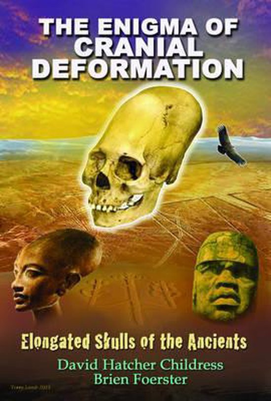 The Enigma of Cranial Deformation