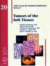 Tumors of the Soft Tissue