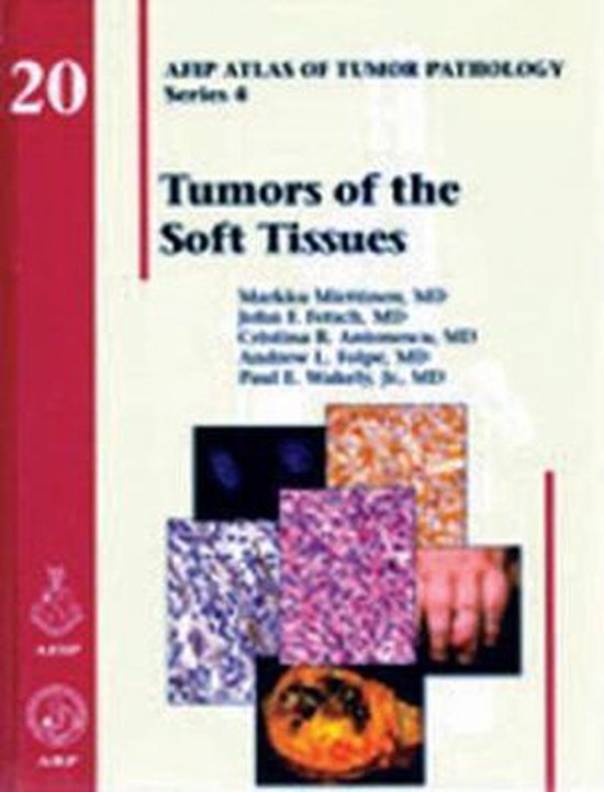 Tumors of the Soft Tissue | 9781933477312 | Markku Miettinen | Boeken ...