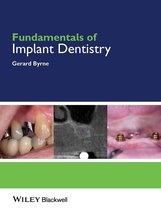 Fundamentals (Dentistry) - Fundamentals of Implant Dentistry