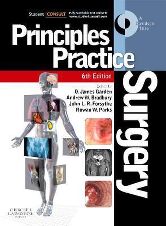 Principles And Practice Of Surgery Rowan W Parks Boeken Bol Com