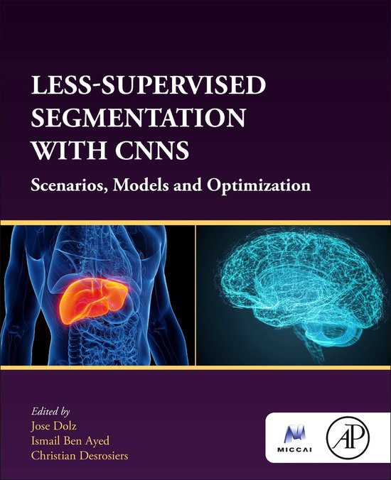 Segmentation Code With Less Samples Less-supervised Segmentation with CNNs | 9780323956741 | Jose Dolz ...