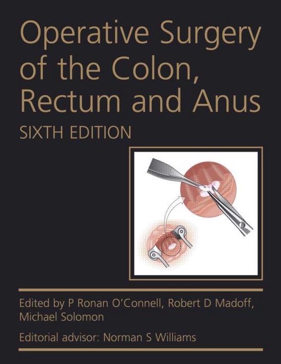Operative Surgery Colon Rectum Anus 6th - cover