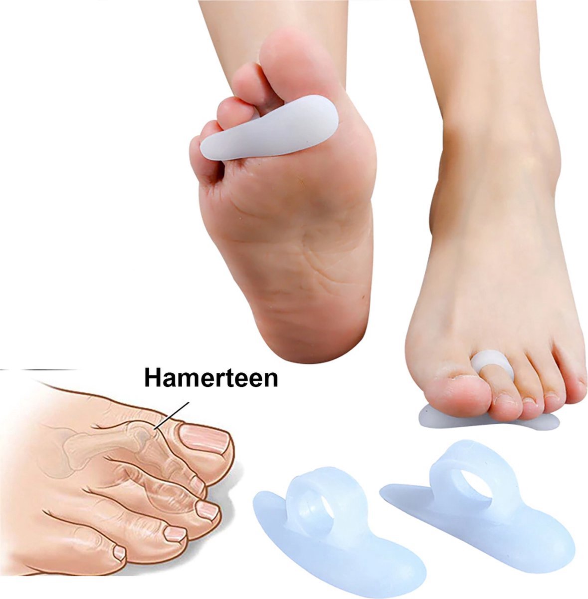 Teencorrector - Hamerteen - Teenspreider - Siliconen - Teenbeschermer - Pijnlijke voeten - Voet accessoire - Voetbescherming - 2 sets (4 stuks)