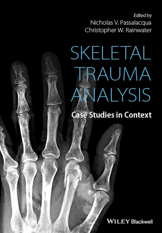 Skeletal Trauma Analysis - cover
