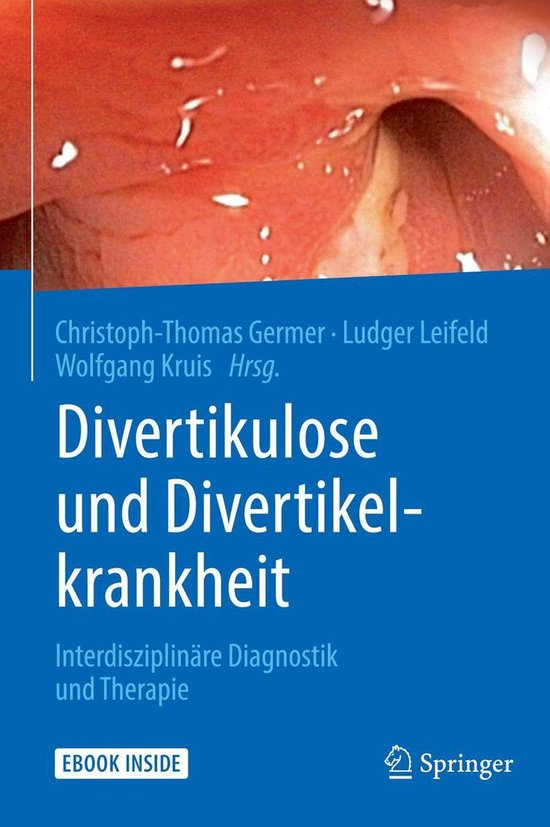Divertikulose und Divertikelkrankheit - cover