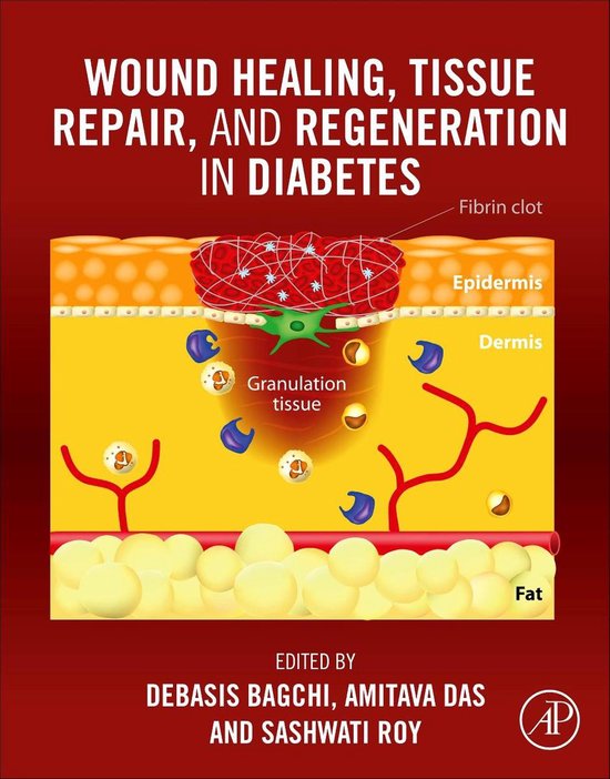 Wound Healing, Tissue Repair, and Regeneration in Diabetes - cover