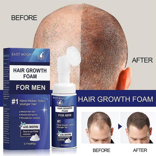 East Moon Haargroei Stimulator Foam – Haarolie & Serum – Hair Oil – Haarvitamines – Haaruitval Mannen & Vrouwen – Haargroei Versneller Schuim
