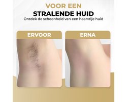 IPL - Ontharingsapparaat - Lichtontharing - IPL ontharing - Wit, Zwart & Roze - 999.999 Flitsen + Gratis Zonnebril & Scheermes