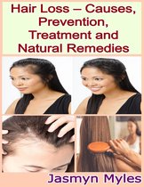 Hair Loss – Causes, Prevention, Treatment and Natural Remedies
