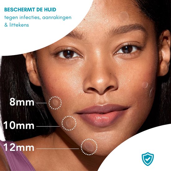 Twenty4seven® Pimple Patch 216 Stuks - Puisten Patches - Tea Tree Olie - Verwijdert Mee-eters, Acne en Puistjes
