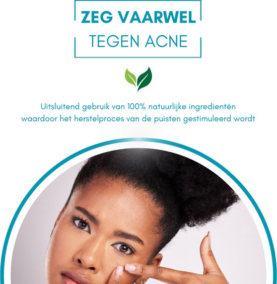 Twenty4seven® Pimple Patch 216 Stuks - Puisten Patches - Tea Tree Olie - Verwijdert Mee-eters, Acne en Puistjes