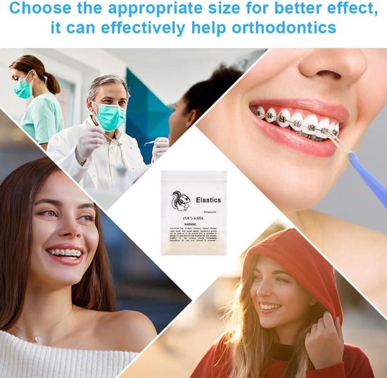 Orthodontische elastiekjes, 300 stuks, multifunctionele orthodontische elastieken, tandopening, banden, transparant, 3/16 inch, elastische tanden, rubberen orale