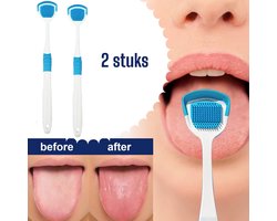 2 stuks tongschraper - tongschrapers - tongreiniger - tong reiniger - tong schraper - Voor Mondverzorging - Tongborstel - tegen slechte adem - reinigt witte tong aanslag