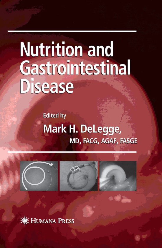 Nutrition and Gastrointestinal Disease - cover